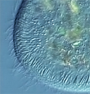 Kammeffekt durch interlaced Scan